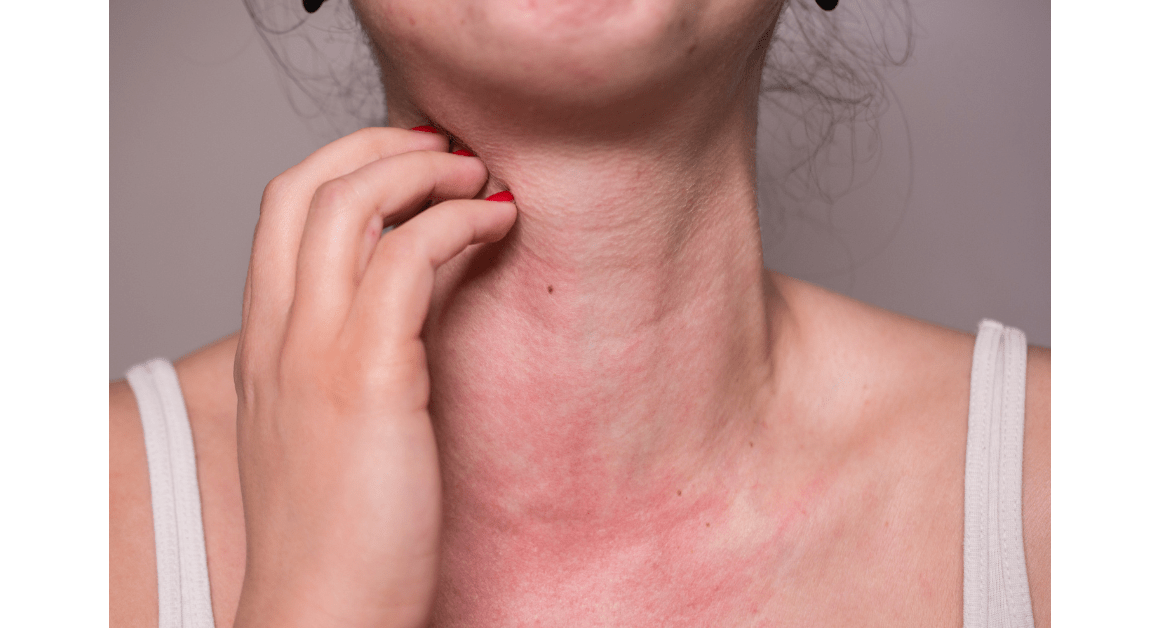 Ragweed, Mold & More: Get Ready for Fall Allergies