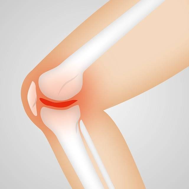 Home Remedies For knee Pain