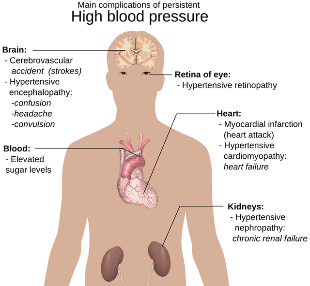 How to Lower Blood Pressure Instantly in an Emergency